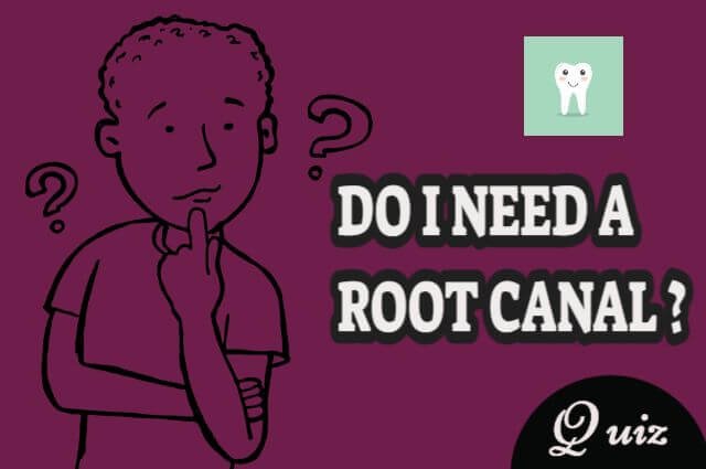 do-i-need-a-root-canal-quiz-with-answers-1-min-quiz